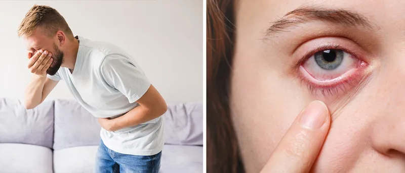 Nausea and dry eyes from a weed hangover